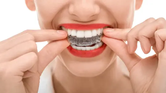 A person putting a transparent dental aligner or retainer